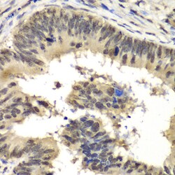 Invitrogen RBBP5 Polyclonal Antibody 100 μL; Unconjugated:Antibodies,