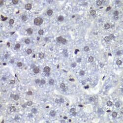 Invitrogen RBBP5 Polyclonal Antibody 100 μL; Unconjugated:Antibodies,