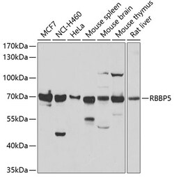 Invitrogen RBBP5 Polyclonal Antibody 100 μL; Unconjugated:Antibodies,
