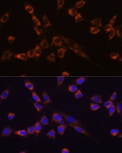 Invitrogen MST2 Polyclonal Antibody 100 &mu;L; Unconjugated:Antibodies,
