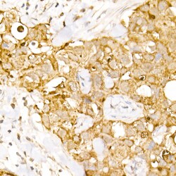 AP3B1 Polyclonal Antibody:Antibodies, Polyclonal