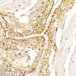AP3B1 Polyclonal Antibody:Antibodies, Polyclonal