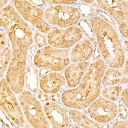 AP3B1 Polyclonal Antibody:Antibodies, Polyclonal