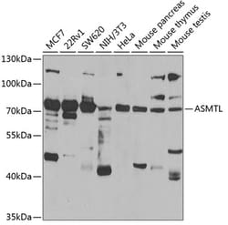 Invitrogen ASMTL Polyclonal Antibody 100 &mu;L; Unconjugated:Antibodies,