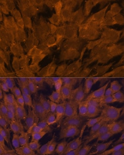 Invitrogen STAM2 Polyclonal Antibody 100 &mu;L; Unconjugated:Antibodies,