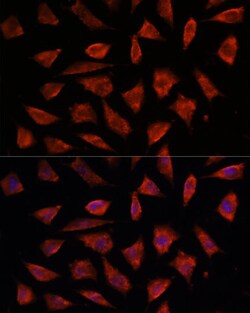 Invitrogen STAM2 Polyclonal Antibody 100 &mu;L; Unconjugated:Antibodies,