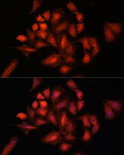 Invitrogen STAM2 Polyclonal Antibody 100 &mu;L; Unconjugated:Antibodies,
