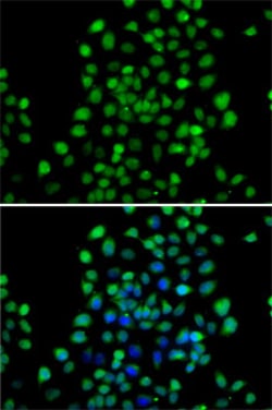 Invitrogen NTMT1 Polyclonal Antibody 100 &mu;L; Unconjugated:Antibodies,
