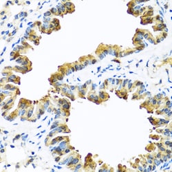 Invitrogen SERPINA10 Polyclonal Antibody 100 &mu;L; Unconjugated:Antibodies,