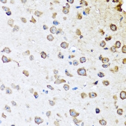 Invitrogen SERPINA10 Polyclonal Antibody 100 &mu;L; Unconjugated:Antibodies,