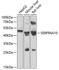 Invitrogen SERPINA10 Polyclonal Antibody 100 &mu;L; Unconjugated:Antibodies,