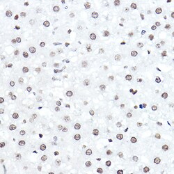 Invitrogen ELF5 Polyclonal Antibody 100 &mu;L; Unconjugated:Antibodies,