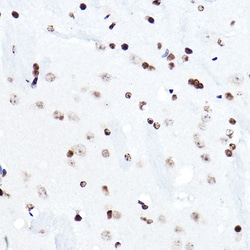 Invitrogen ELF5 Polyclonal Antibody 100 &mu;L; Unconjugated:Antibodies,