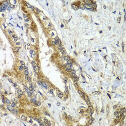 Invitrogen APC6 Polyclonal Antibody 100 &mu;L; Unconjugated:Antibodies,