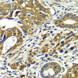Invitrogen APC6 Polyclonal Antibody 100 &mu;L; Unconjugated:Antibodies,