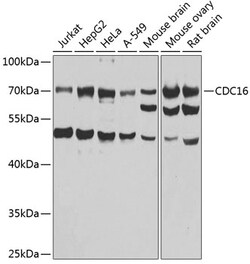 Invitrogen APC6 Polyclonal Antibody 100 &mu;L; Unconjugated:Antibodies,