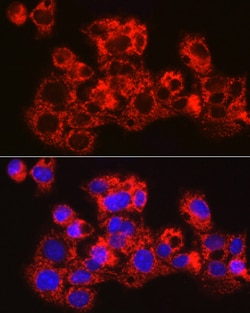 Invitrogen METTL7B Polyclonal Antibody 100 &mu;L; Unconjugated:Antibodies,