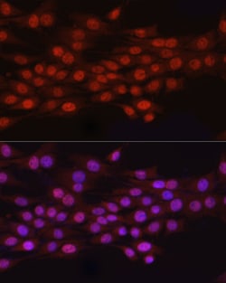 Invitrogen N6AMT1 Polyclonal Antibody 100 &mu;L; Unconjugated:Antibodies,