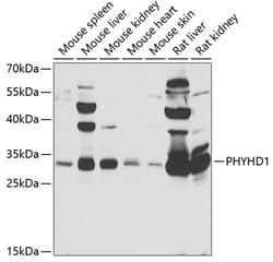 Invitrogen PHYHD1 Polyclonal Antibody 100 &mu;L; Unconjugated:Antibodies,