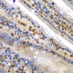 Invitrogen HnRNP Q Polyclonal Antibody 100 &mu;L; Unconjugated:Antibodies,