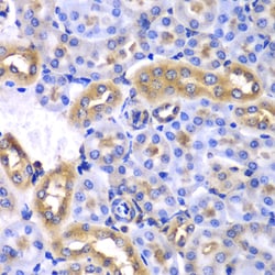 Invitrogen HnRNP Q Polyclonal Antibody 100 &mu;L; Unconjugated:Antibodies,