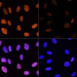Invitrogen H3K14ac Polyclonal Antibody 100 &mu;L; Unconjugated:Antibodies,