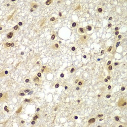 Invitrogen ZNF20 Polyclonal Antibody 100 &mu;L; Unconjugated:Antibodies,