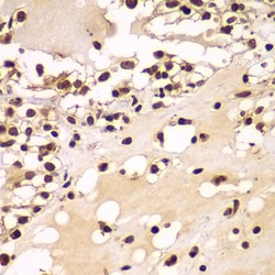 Invitrogen ZNF20 Polyclonal Antibody 100 &mu;L; Unconjugated:Antibodies,