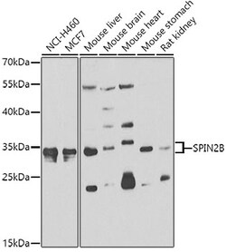 Invitrogen SPIN2 Polyclonal Antibody 100 μL; Unconjugated:Antibodies,