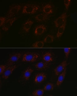 Invitrogen BCAT2 Polyclonal Antibody 100 &mu;L | Buy Online | Invitrogen&trade; | Fisher Scientific
