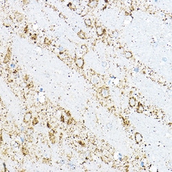 Invitrogen BCAT2 Polyclonal Antibody 100 &mu;L | Buy Online | Invitrogen&trade; | Fisher Scientific