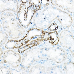 Invitrogen BCAT2 Polyclonal Antibody 100 &mu;L | Buy Online | Invitrogen&trade; | Fisher Scientific