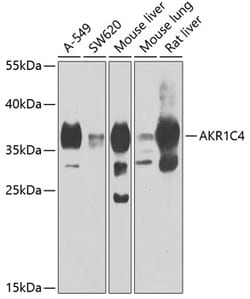 Invitrogen AKR1C4 Polyclonal Antibody 100 &mu;L; Unconjugated:Antibodies,