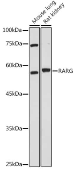 Invitrogen RAR gamma-1,2 Polyclonal Antibody 100 &mu;L; Unconjugated:Antibodies,