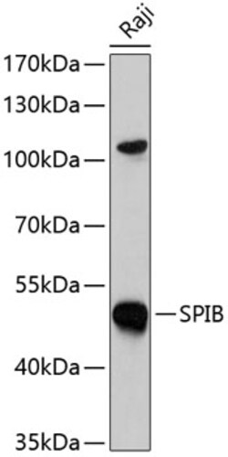 Invitrogen SPIB Polyclonal Antibody 100 &mu;L; Unconjugated:Antibodies,