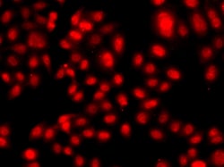 Invitrogen TEF5 Polyclonal Antibody 100 &mu;L; Unconjugated:Antibodies,