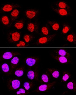Invitrogen TEF5 Polyclonal Antibody 100 &mu;L; Unconjugated:Antibodies,