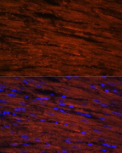 Invitrogen LDB3 Polyclonal Antibody 100 &mu;L | Buy Online | Invitrogen&trade; | Fisher Scientific
