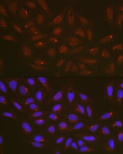 Invitrogen ATG14 Polyclonal Antibody 100 &mu;L; Unconjugated:Antibodies,