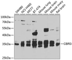Invitrogen CBR3 Polyclonal Antibody 100 &mu;L; Unconjugated:Antibodies,