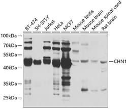 Invitrogen CHN1 Polyclonal Antibody 100 &mu;L; Unconjugated:Antibodies,