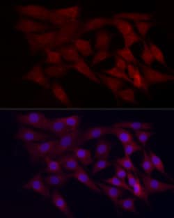 Invitrogen WDR45 Polyclonal Antibody 100 &mu;L | Buy Online | Invitrogen&trade; | Fisher Scientific