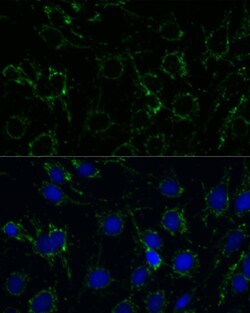 Invitrogen GluD1 Polyclonal Antibody 100 &mu;L; Unconjugated:Antibodies,