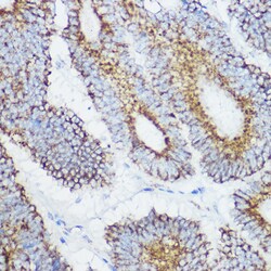 Invitrogen GluD1 Polyclonal Antibody 100 &mu;L; Unconjugated:Antibodies,