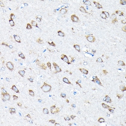 Invitrogen ETFA Polyclonal Antibody 100 &mu;L; Unconjugated:Antibodies,