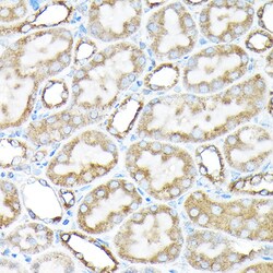 Invitrogen ETFA Polyclonal Antibody 100 &mu;L; Unconjugated:Antibodies,