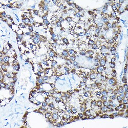 Invitrogen ETFA Polyclonal Antibody 100 &mu;L; Unconjugated:Antibodies,
