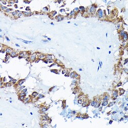 Invitrogen ETFA Polyclonal Antibody 100 &mu;L; Unconjugated:Antibodies,
