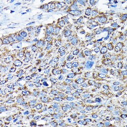 Invitrogen ETFA Polyclonal Antibody 100 &mu;L; Unconjugated:Antibodies,