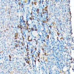 Invitrogen ETFA Polyclonal Antibody 100 &mu;L; Unconjugated:Antibodies,
